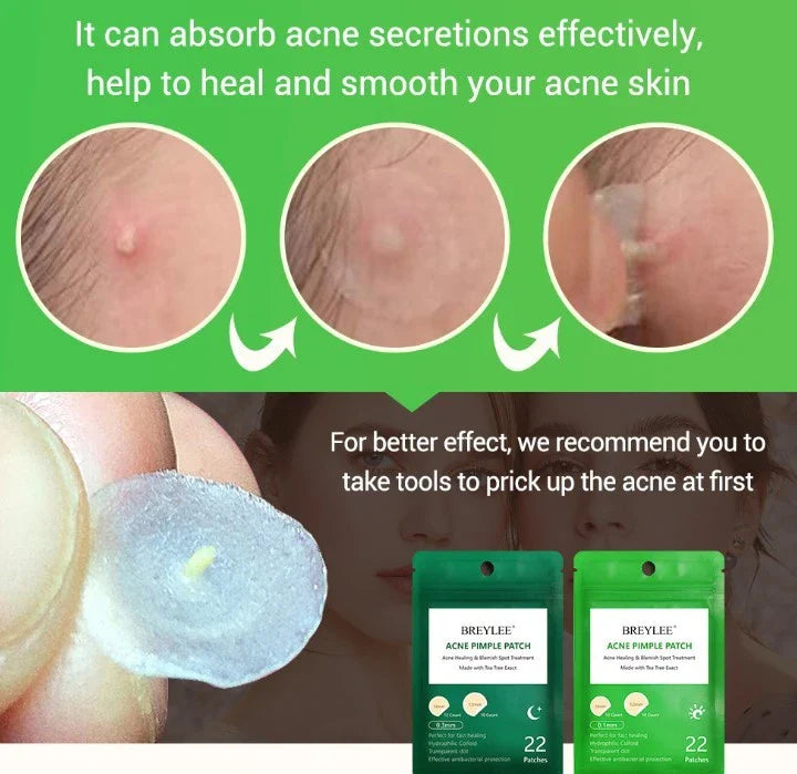 Discreet tea tree spot patches to fade acne marks and blemishes, with a transparent and ultra-thin design for natural-looking coverage.