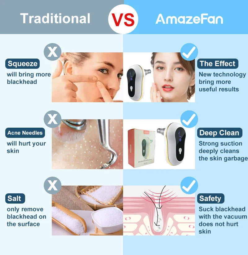 An electric pore vacuum cleaner with a white body and USB power source, designed to deep clean pores and remove blackheads for smooth, radiant skin.