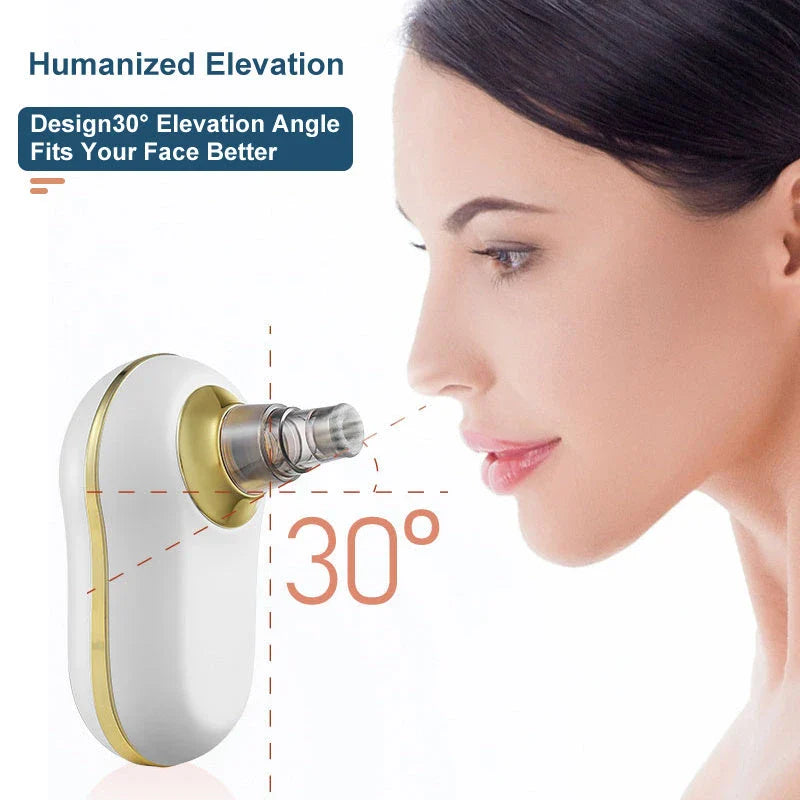 An electric pore vacuum cleaner with a white body and USB power source, designed to deep clean pores and remove blackheads for smooth, radiant skin.