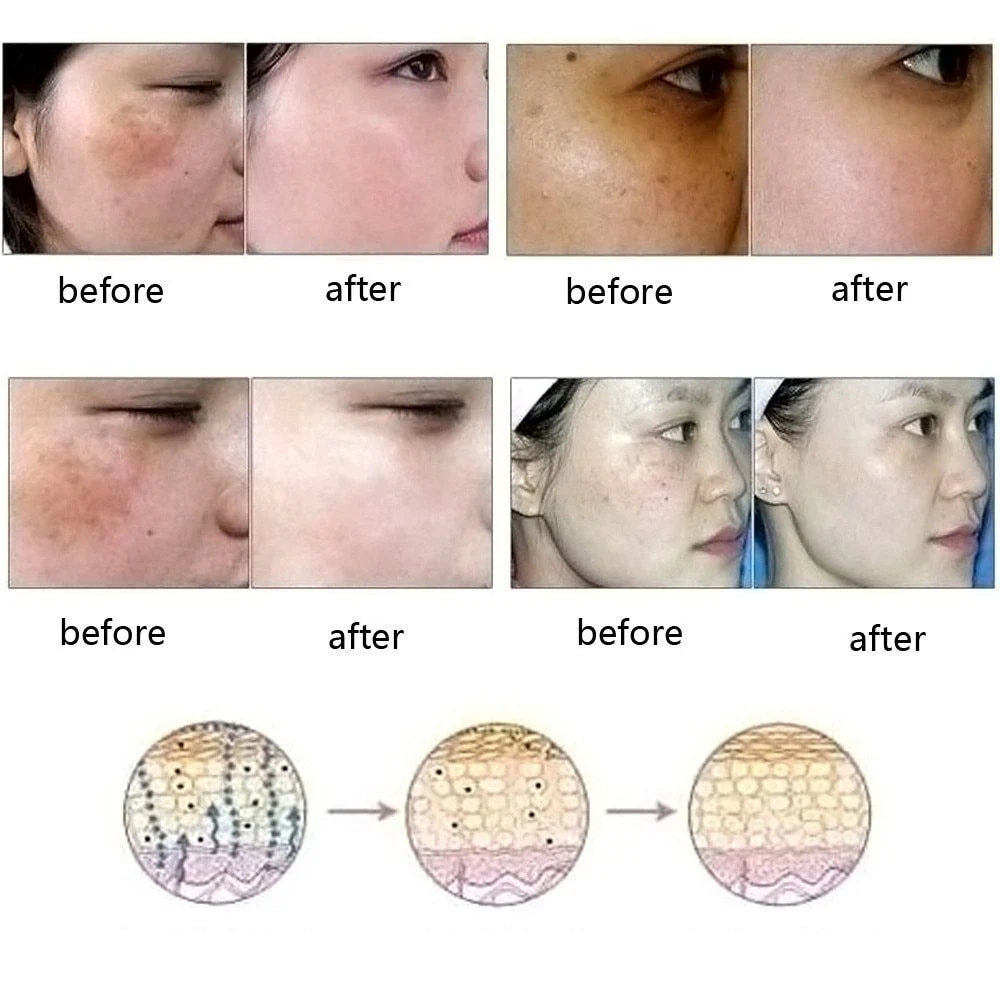 Dredge Meridian Skin Care Oil - a natural formula that fades dark spots, discoloration, and imperfections for brighter, smoother skin