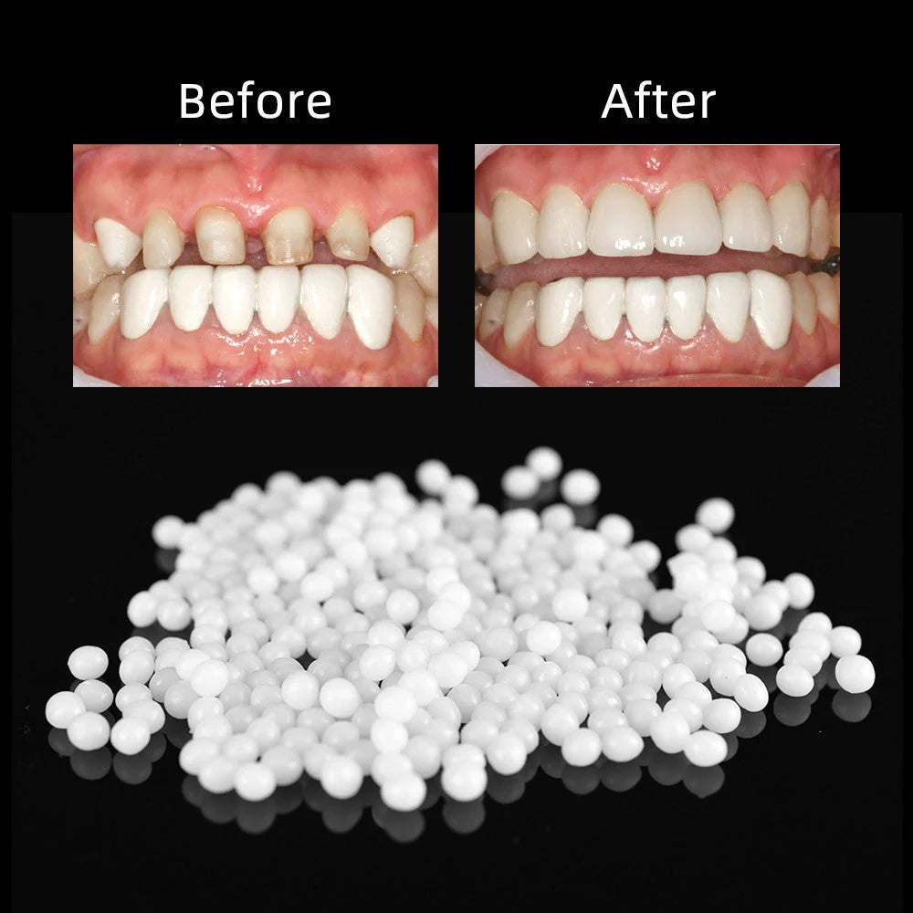 Household teeth repair solid hot-soluble teether for temporary missing teeth gap