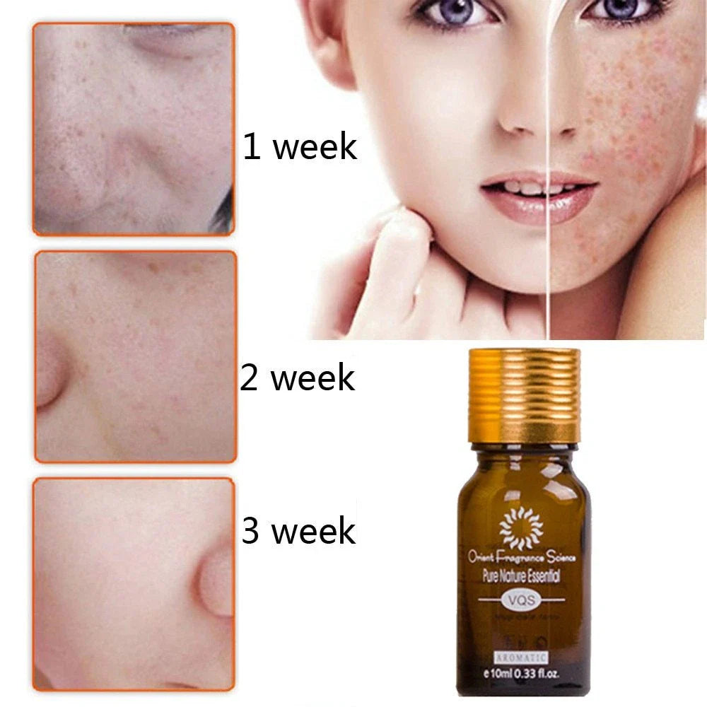 Dredge Meridian Skin Care Oil - a natural formula that fades dark spots, discoloration, and imperfections for brighter, smoother skin