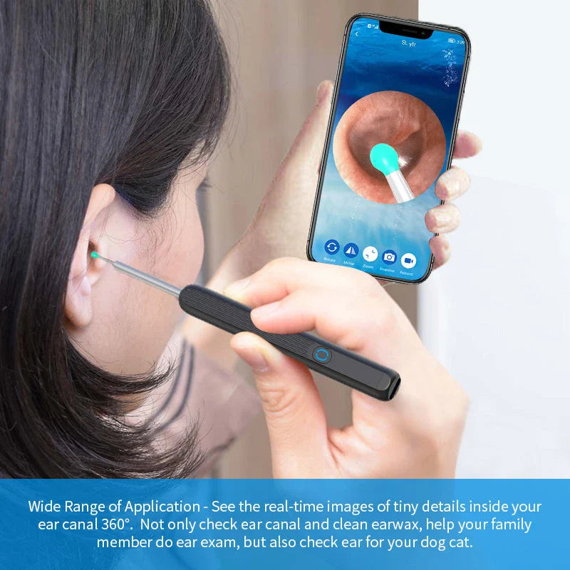 Wireless Otoscope Ear Wax Removal Tool with 360° HD Camera and LED Light for Comprehensive Ear Examination and Cleaning