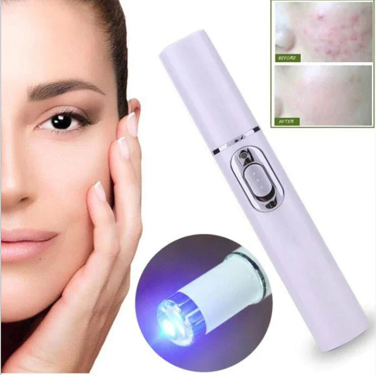 Portable Skin Reviving Laser Pen with Blue Light Therapy and Massage for Acne, Wrinkles, and Dark Circles