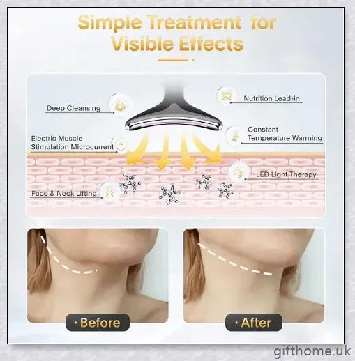 Double Chin Reducer Device - Microcurrent Technology for Neck & Face Wrinkle Reduction