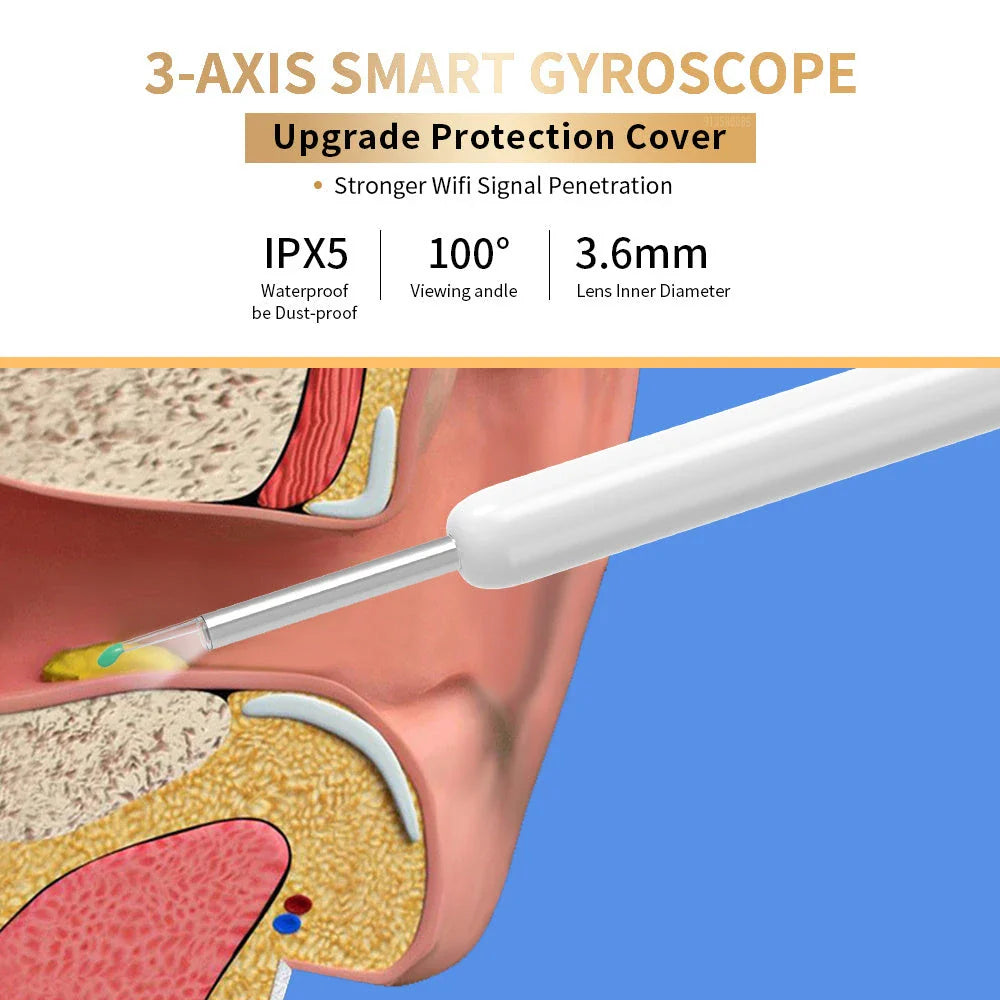 Wireless Otoscope Ear Wax Removal Tool with 360° HD Camera and LED Light for Comprehensive Ear Examination and Cleaning
