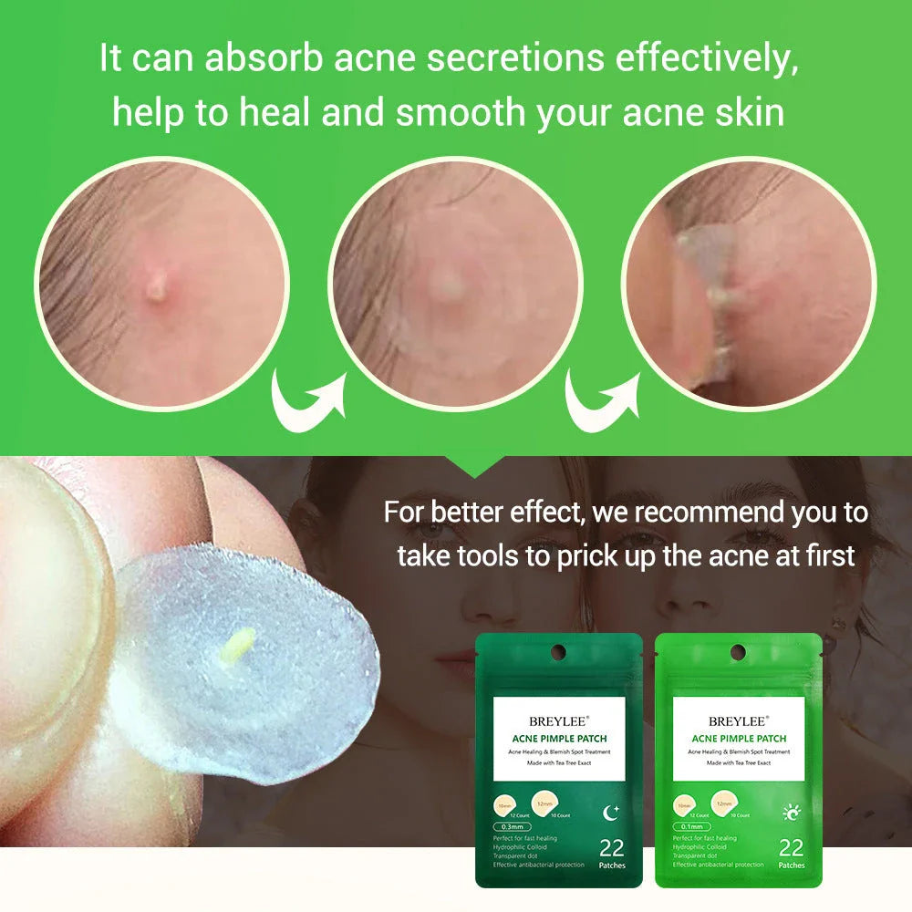 Discreet tea tree spot patches to fade acne marks and blemishes, with a transparent and ultra-thin design for natural-looking coverage.