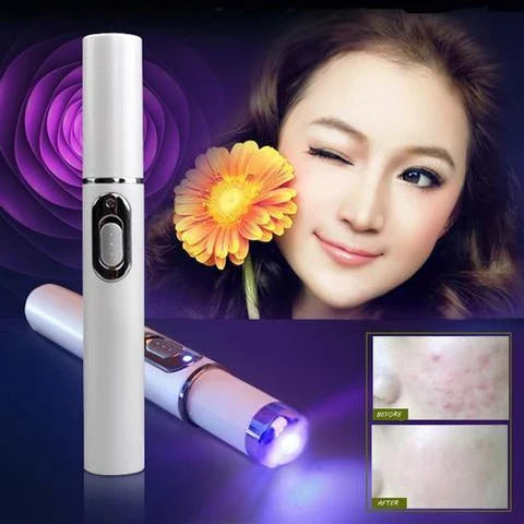 Blue light therapy pen for treating acne, scars, and wrinkles on the face and body