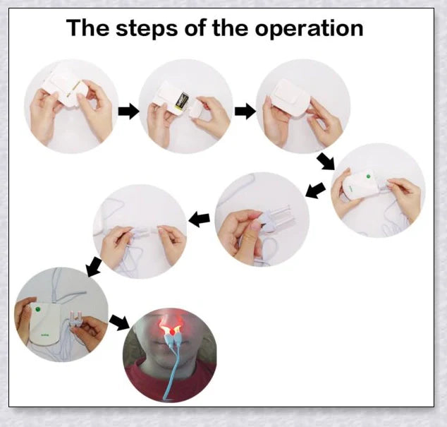 Infrared Rhinitis Therapy Device - A revolutionary medical-grade solution for allergy relief and nasal comfort