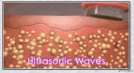 Body Slimming and Anti-Cellulite Massager with Ultrasonic Cavitation Fat Burning Technology
