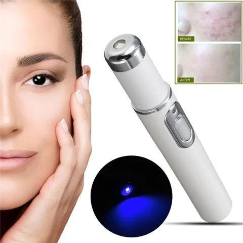 Blue light therapy pen for treating acne, scars, and wrinkles on the face and body