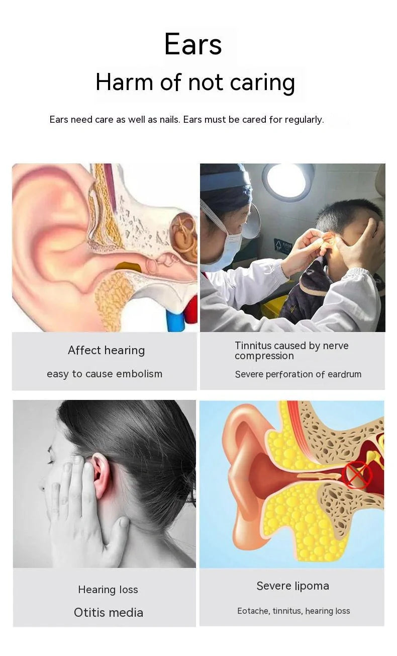 HD Wireless Smart Endoscope with Luminous Ear Pick for safe ear cleaning