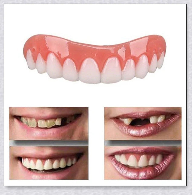 Magic Teeth Brace Veneer - Custom-fitted dental veneers to instantly transform your smile