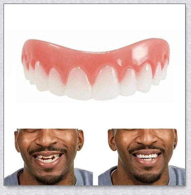 Magic Teeth Brace Veneer - Custom-fitted dental veneers to instantly transform your smile