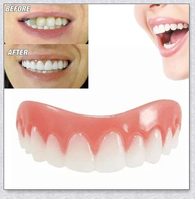 Magic Teeth Brace Veneer - Custom-fitted dental veneers to instantly transform your smile