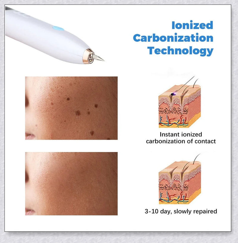 GiftHome Skin Tag Wart Mole Remover Plasma Pen