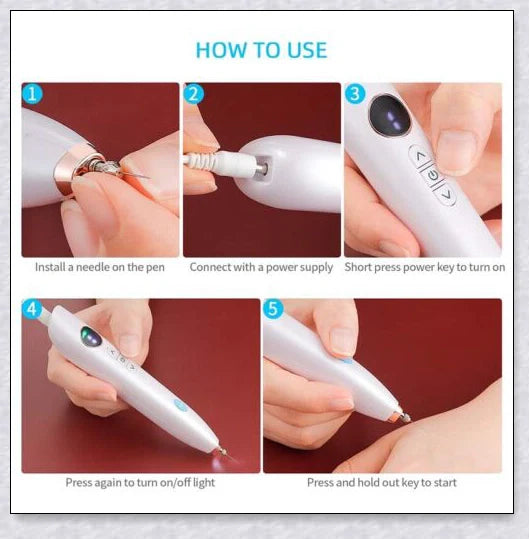 Skin Tag Wart Mole Remover Plasma Pen - Convenient at-home solution for removing skin imperfections