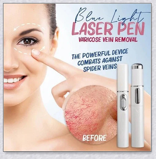 Spider Veins Removal Pen - a high-intensity light device to eliminate varicose veins, treat acne, and promote lymph detoxification