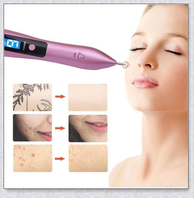 Skin Tag and Mole Remover - Innovative nano-needle technology for safe, effective blemish removal