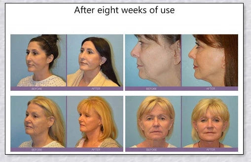 Mini Microcurrent Face Lift Machine for anti-aging skin tightening and rejuvenation