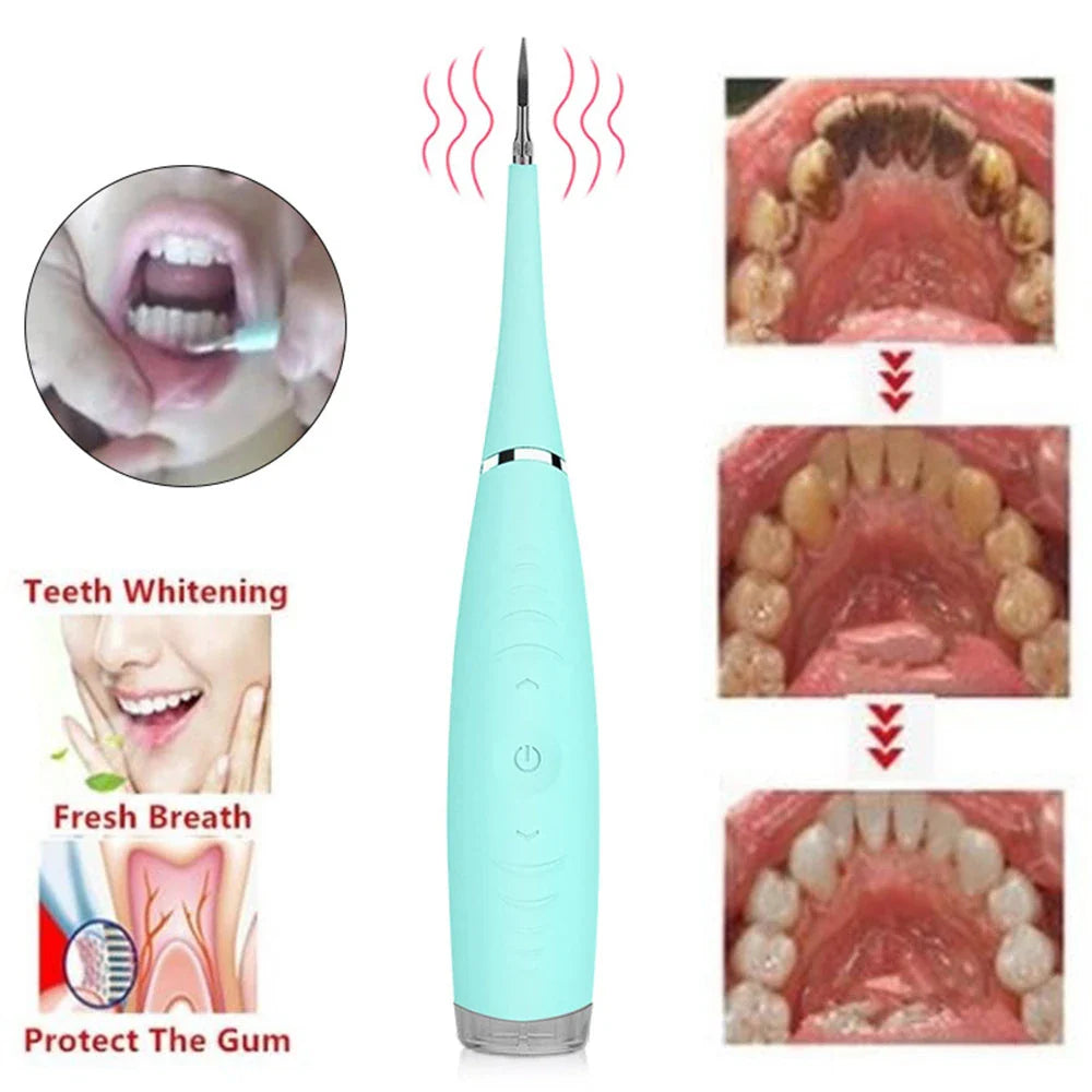 Waterproof Electric Toothbrush Cleaner with Vibrating Head, Silica Gel and ABS Materials, Ergonomic Handle for Effective Plaque and Tartar Removal