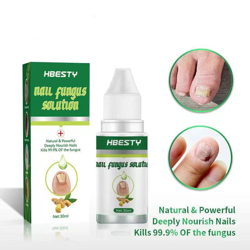 Nail Fungus Treatment Solution with Natural Ingredients Like Honeysuckle and Hyaluronic Acid