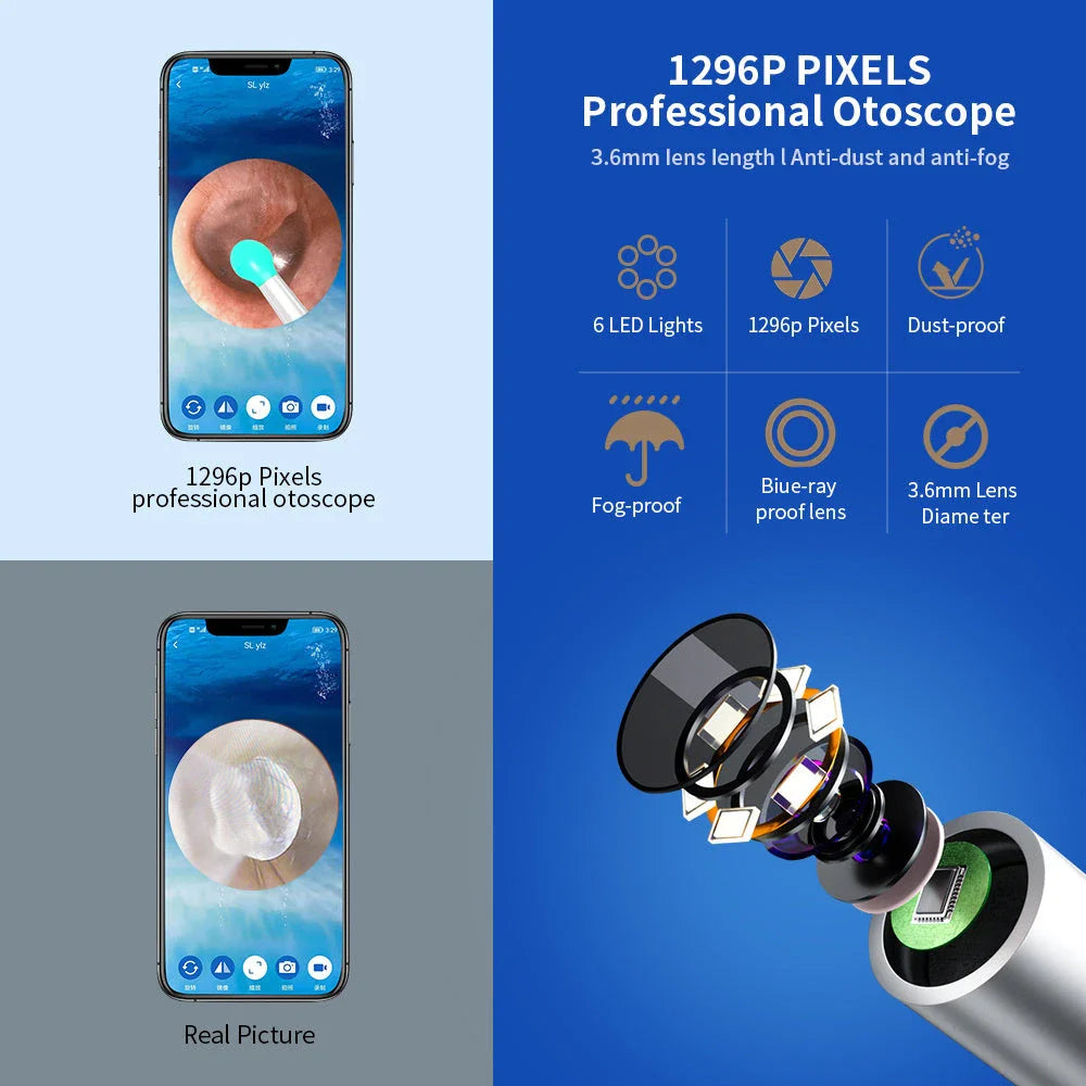 Wireless Otoscope Ear Wax Removal Tool with 360° HD Camera and LED Light for Comprehensive Ear Examination and Cleaning