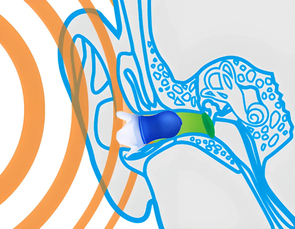 Multipurpose pressure-equalising earplugs in blue silicone with clear flanges, designed for comfortable in-flight use and various noise-filled activities.