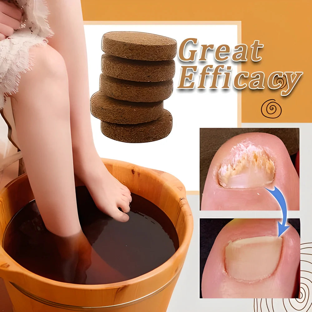 Premium Anti-Fungal Detox Foot Soak Treatment with natural ingredients for cleansing, soothing, and revitalising feet