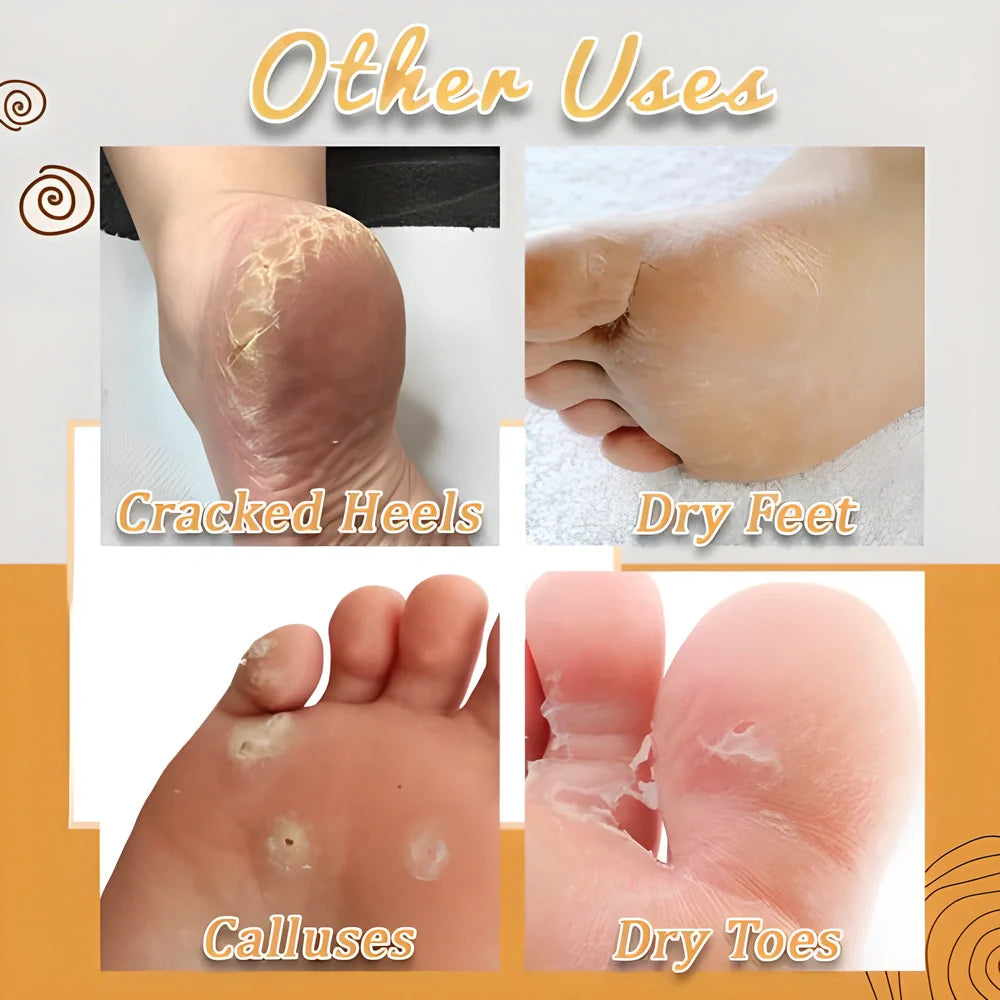 Premium Anti-Fungal Detox Foot Soak Treatment with natural ingredients for cleansing, soothing, and revitalising feet