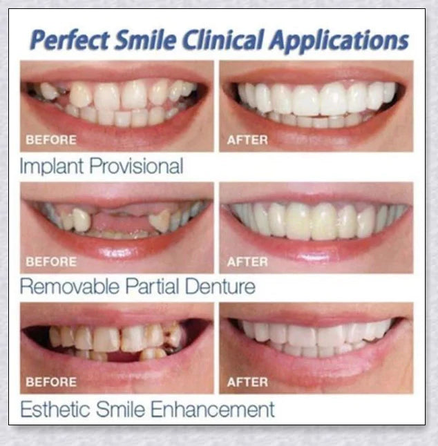 Premium snap-on veneers made with micro-thin polypropylene to instantly transform your smile