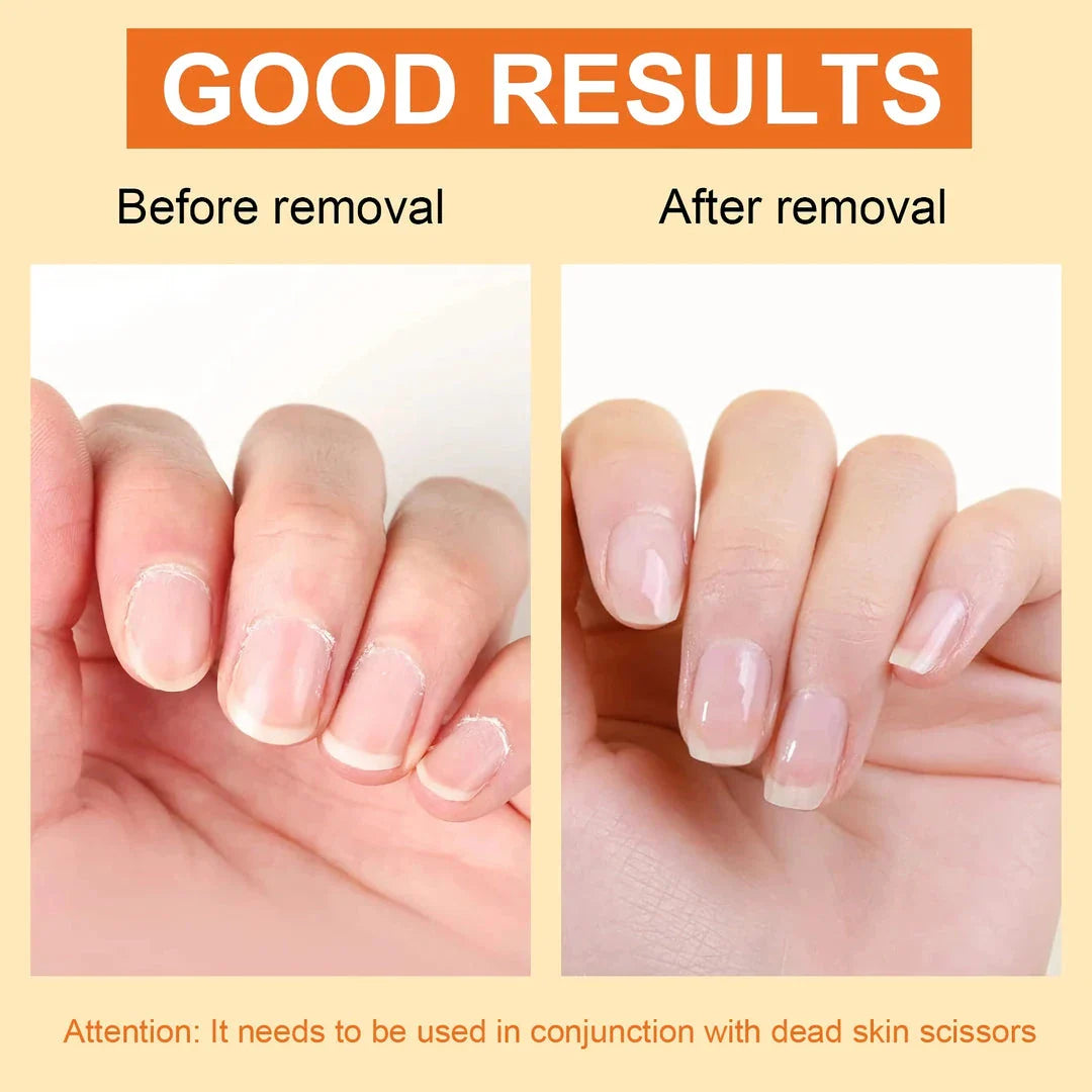 Premium 15ml cuticle softener and moisturiser for hand and foot nail care, softens and hydrates dry, brittle nails