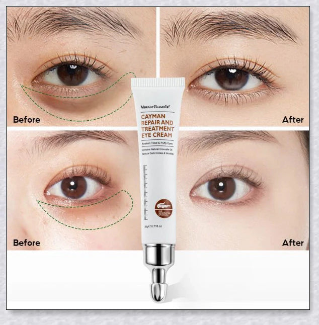 Magic Eye Cream that instantly reduces bags, dark circles, and wrinkles in 28 seconds for radiant, youthful-looking eyes
