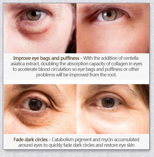 Magic Eye Cream that instantly reduces bags, dark circles, and wrinkles in 28 seconds for radiant, youthful-looking eyes