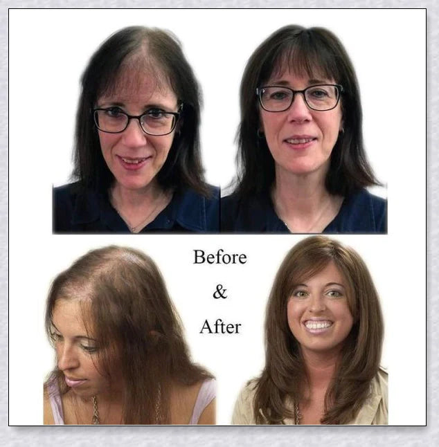 Volumising Hair Topper Clip for Women - Instantly Add Volume and Coverage to Your Hair