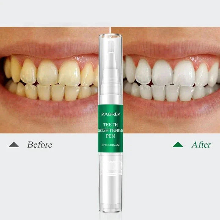 Instant Teeth Whitening Pen - Compact and convenient tool for a brighter, whiter smile
