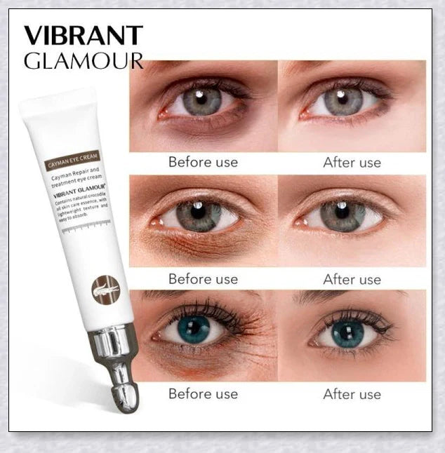 Magic Eye Cream that instantly reduces bags, dark circles, and wrinkles in 28 seconds for radiant, youthful-looking eyes