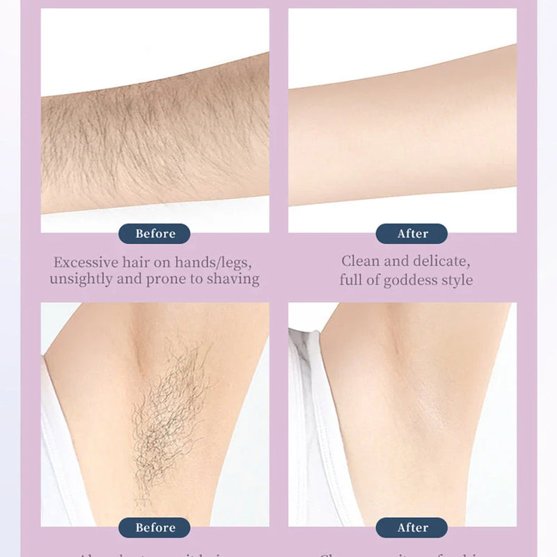 GiftHome UK Rechargeable 3-in-1 Hair Removal Epilator and Shaver for Smooth, Hair-Free Skin
