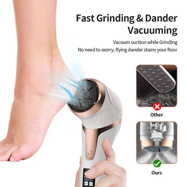 Electric Foot Dead Skin Remover, foot exfoliator with rechargeable battery and ergonomic design for smooth, soft feet
