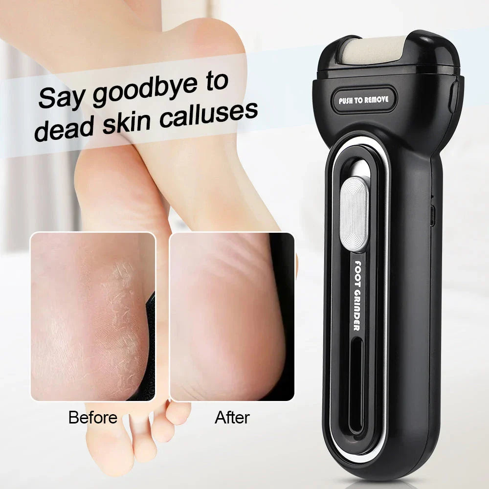 Premium electric foot callus remover with multiple grinding heads for effective, gentle callus removal and smooth, rejuvenated feet