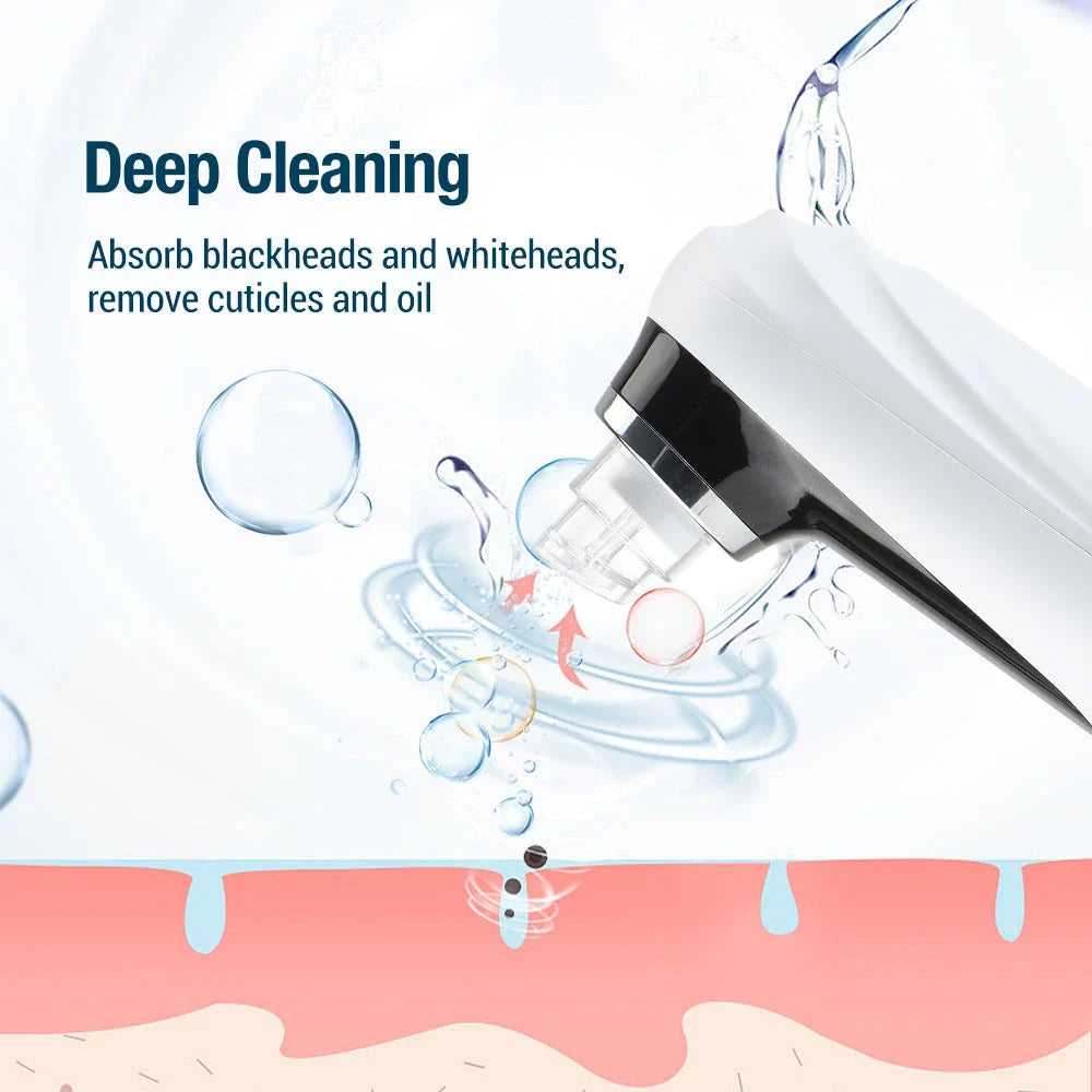 Premier Electric Pore Vacuum and Blackhead Remover - Advanced skincare device for deep cleansing, pore extraction, and skin rejuvenation