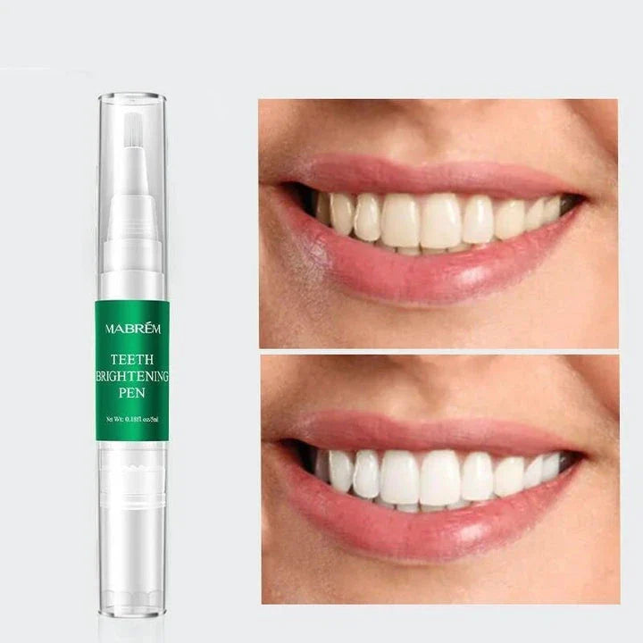 Instant Teeth Whitening Pen - Compact and convenient tool for a brighter, whiter smile