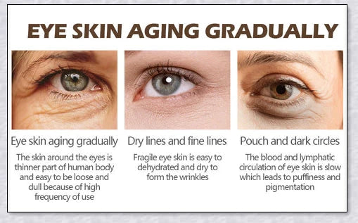 Magic Eye Cream that instantly reduces bags, dark circles, and wrinkles in 28 seconds for radiant, youthful-looking eyes