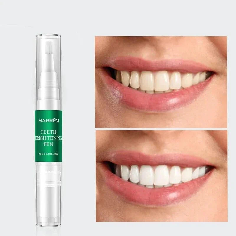 Instant Teeth Whitening Pen - Compact and convenient tool for a brighter, whiter smile