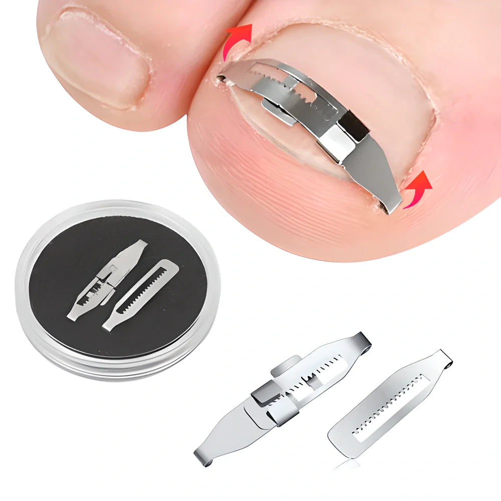 Premium professional ingrown toenail corrector tool with adjustable orthopedic nail buckle, made from durable stainless steel