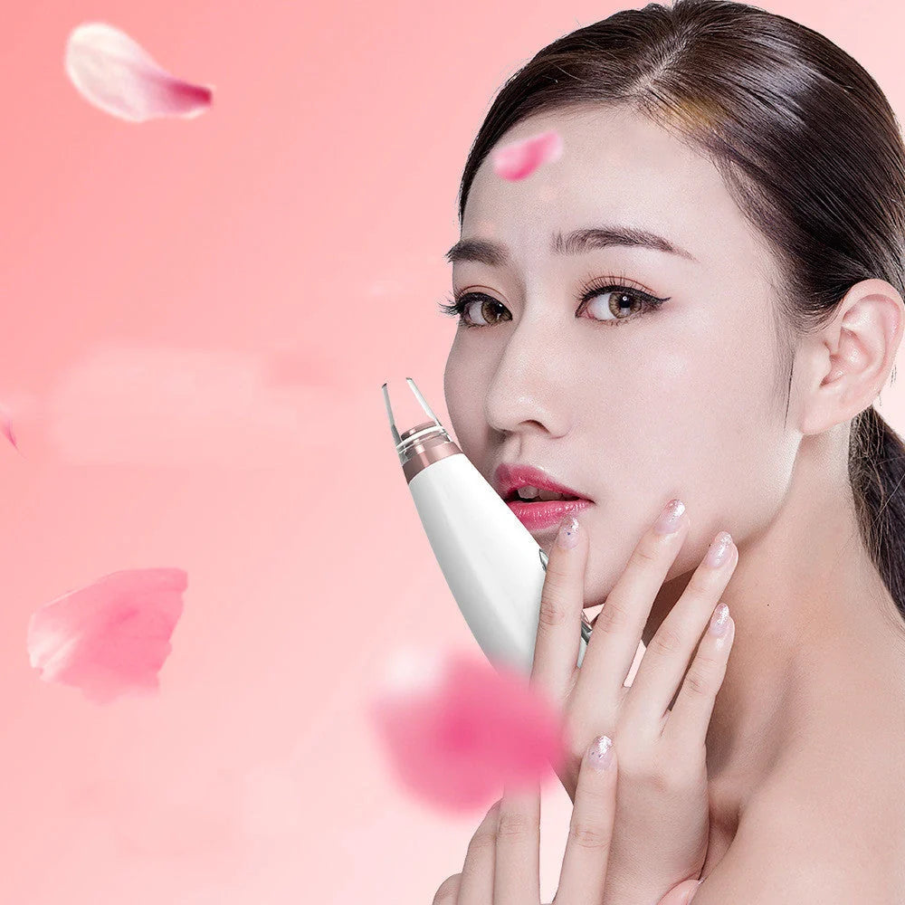 Premium blackhead removal device with advanced suction technology for a clear, radiant complexion