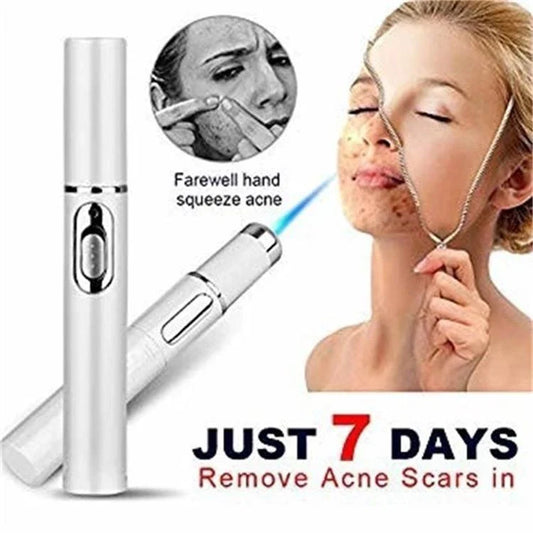 Blue light therapy pen for treating acne, scars, and wrinkles on the face and body