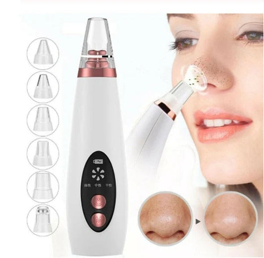 Premium blackhead removal device with advanced suction technology for a clear, radiant complexion