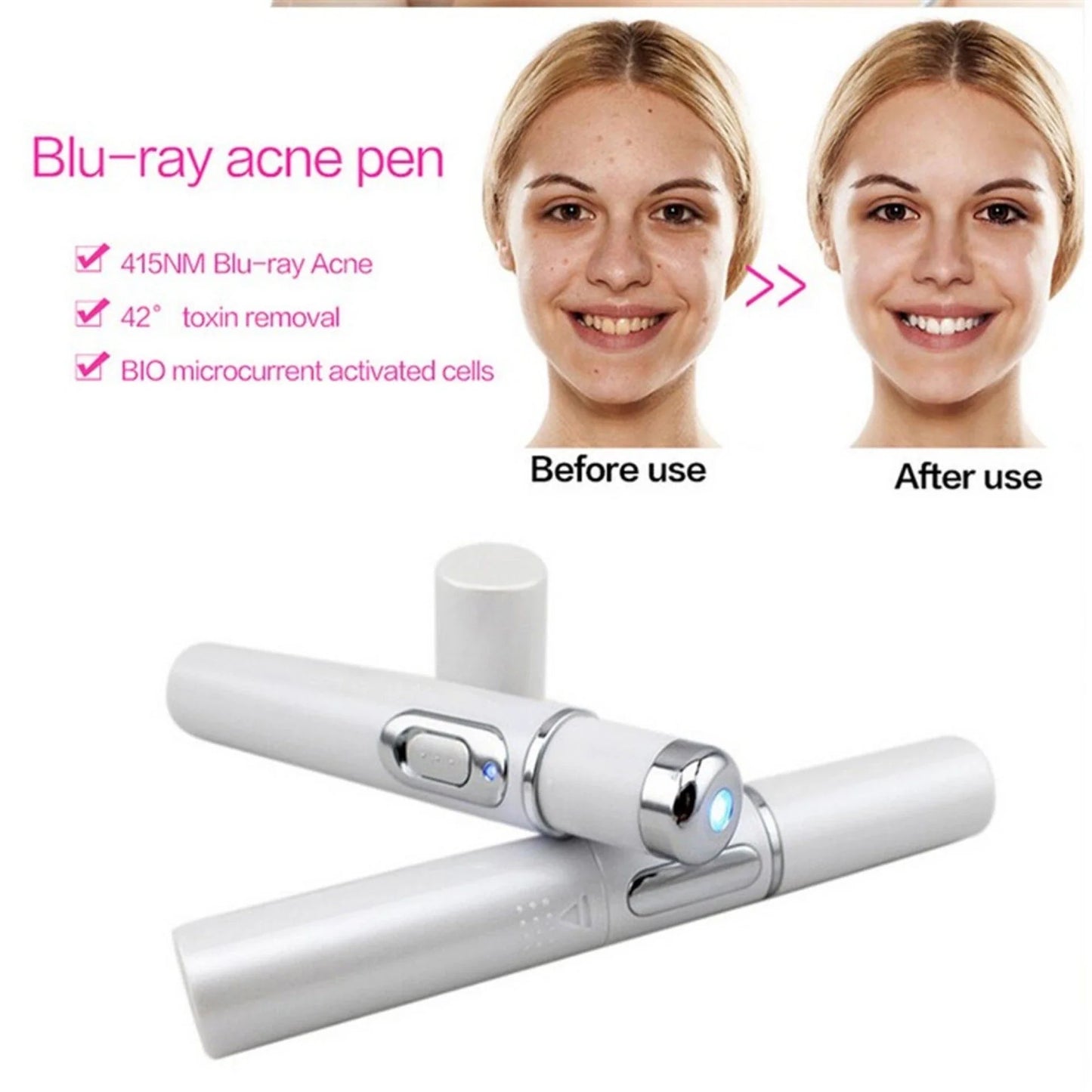 Blue light therapy pen for treating acne, scars, and wrinkles on the face and body