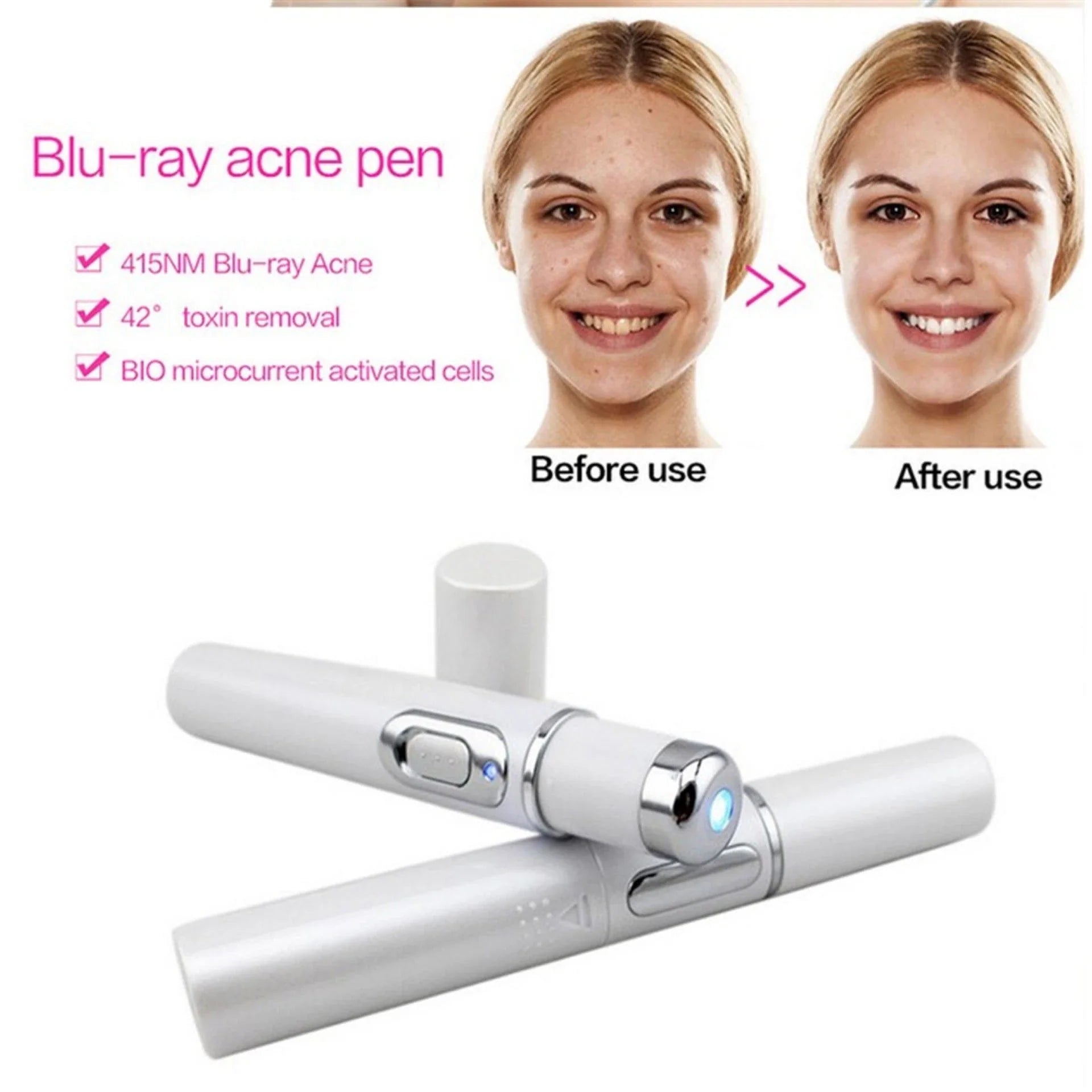 Blue light therapy pen for treating acne, scars, and wrinkles on the face and body